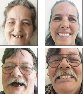 w160515_DentalCare_a